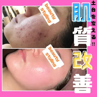 痩身&美肌サロン 堀米✨のその他イメージ