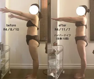 痩身サロンiBDY所属・いわきり ゆきのエステ・リラクイメージ