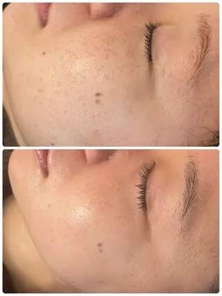 luana beauty所属・kana ハーブピーリング🌿のエステ・リラクイメージ