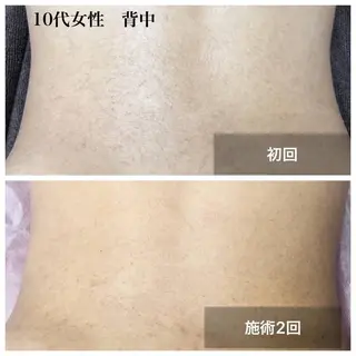 アルカンジュ~archange~所属・痩身/毛穴洗浄/脱毛 アルカンジュのエステ・リラクイメージ