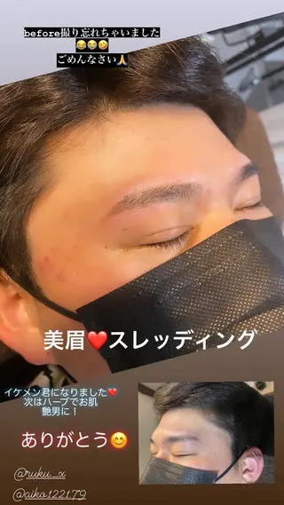 アイブロウ ハーブピーリング/韓国肌管理/フェイシャル/毛穴洗浄/眉毛/顔脱毛【糸脱毛専門】rev所属・ハーブピーリング🌹 毛穴洗浄❤️眉waxのエステ・リラクイメージ