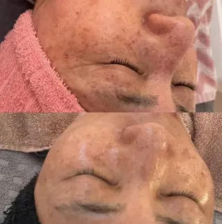 beauty lanaのエステ・リラクイメージ