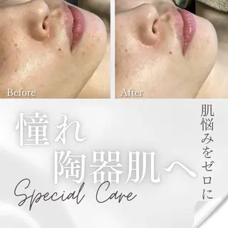 💚THE BALM 金子💚✨のエステ・リラクイメージ