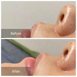 産毛専門店 Bittoのエステ・リラクイメージ