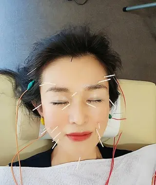 お顔のむくみたるみ 専門☆美容鍼小顔矯正のエステ・リラクイメージ