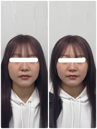 美容鍼×小顔矯正 ×美容整体 浜川泰仁のエステ・リラクイメージ