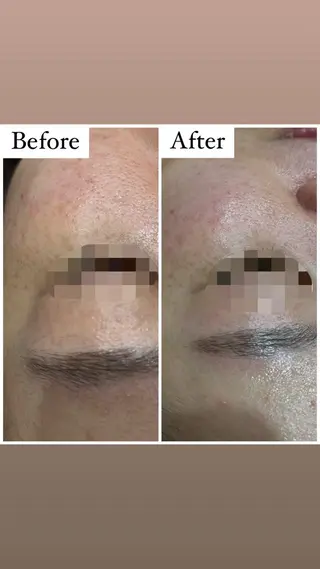 ハーブピーリング専門 muro.のエステ・リラクイメージ