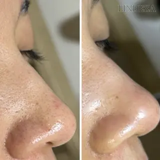 private salon 𝐋𝐈𝐍𝐃𝐄𝐙𝐀所属・LINDEZA Ayaのエステ・リラクイメージ