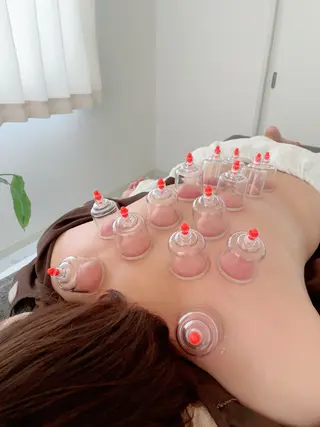 美容鍼＆鍼灸サロン 鍼Glitter.所属・田中 美奈のエステ・リラクイメージ