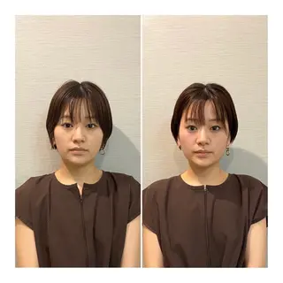 ショート 即小顔♥️美容鍼× ハーブピーリングのその他イメージ