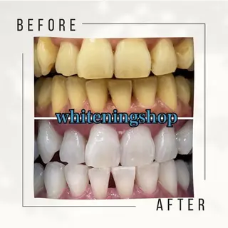 ホワイトニング ショップ千葉店のその他イメージ