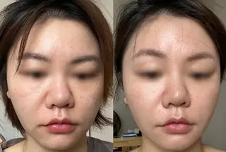 aliaハイフ&水光ジェットサロン所属・aliaハーブ水光店 エステティシャン募集のエステ・リラクイメージ