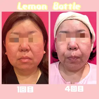 SOIS上中居店所属・佐々木 麻裕のエステ・リラクイメージ