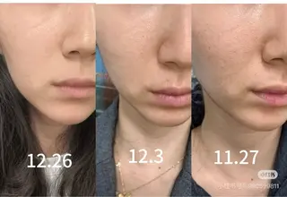 マツエク・マツパ aliaハイフ&水光ジェットサロン所属・aliaハーブ水光店 エステティシャン募集のエステ・リラクイメージ