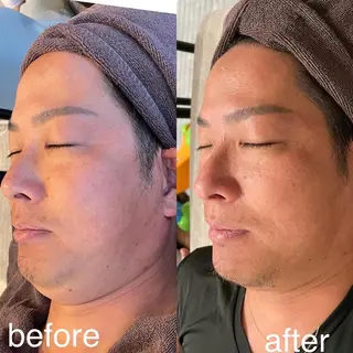 Lavi&所属・肌質改善サロン Lavi&のその他イメージ