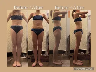 Bodyリカバリー栗山整骨院所属・Arisa｜阪神西宮 肩こり腰痛リンパ痩身のエステ・リラクイメージ