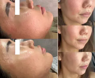 ALIA Scintiller  アリアサンティエ所属・齋藤 祐里耶のエステ・リラクイメージ