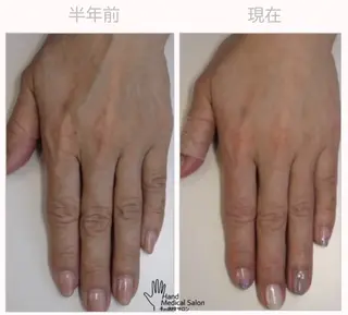 ネイル 自爪育成専門サロンbelltiffy所属・オーナーネイリスト 宮添華里のネイルデザイン