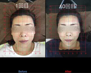 小顔矯正/美容整体 /骨盤矯正✨+Mi2のエステ・リラクイメージ