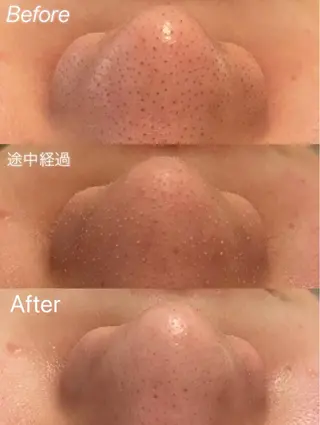 Remina clinical salon所属・ハイフ美肌専門 Remina.c.sのエステ・リラクイメージ