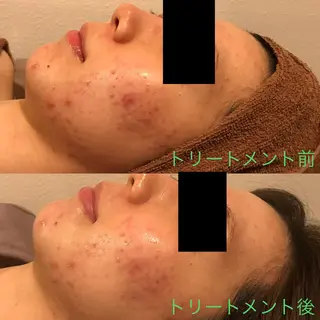 サロンドゥ ルシエルのエステ・リラクイメージ