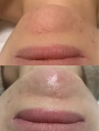 me coutureのマツエク・マツパデザイン