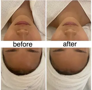 POLA　R-isa所属・小顔マッサージ 毛穴/POLAのエステ・リラクイメージ