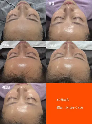 小顔専門看護師クリニカルサロンCOCO所属・小顔と美肌サロン クリニカルサロンココのエステ・リラクイメージ