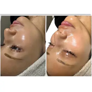 yuuri. Sの眉毛・アイブロウイメージ