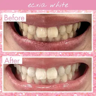 エクシアホワイトニング伊勢店所属・セルフホワイトニング エクシア伊勢店のその他イメージ