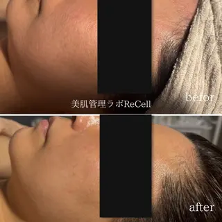 FLORALNOTE所属・ReCell 肌管理のエステ・リラクイメージ