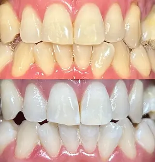 io teeth careのその他イメージ