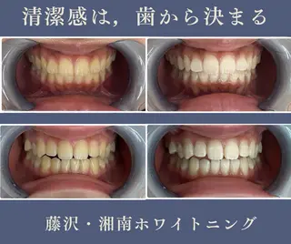 マツエク・マツパ glitter.SHONAN所属・ホワイトニング専門店 glitterのその他イメージ