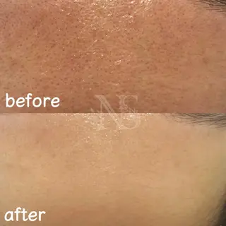 Nature Souce毛穴専門店のその他イメージ