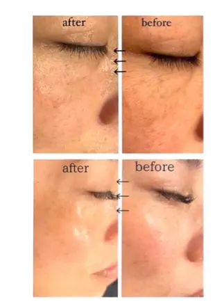 private salon　Repe所属・Repe miyukiのマツエク・マツパデザイン