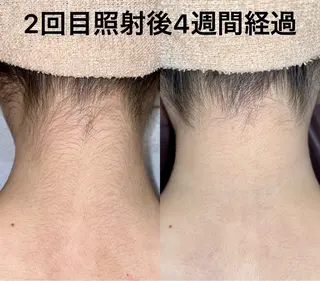 グレイスフルルーム所属・【本格脱毛】 グレイスフルルームのエステ・リラクイメージ