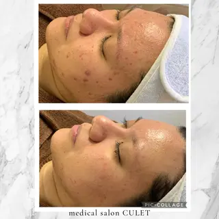 medical   salon    CULET所属・CULET HIDEMIのエステ・リラクイメージ