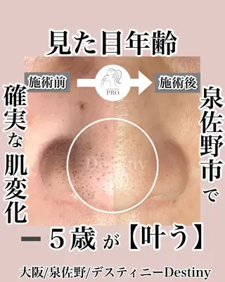 泉佐野 Destinyのエステ・リラクイメージ