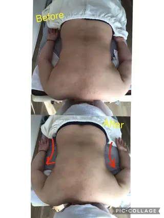 子宮矯正/腸揉み/ シュガーリング脱毛のエステ・リラクイメージ