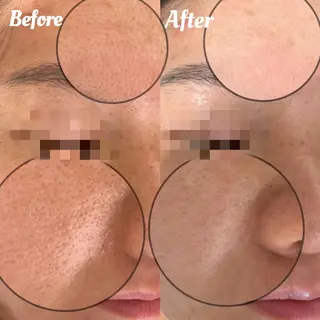 肌管理専門店 Shandeelのエステ・リラクイメージ