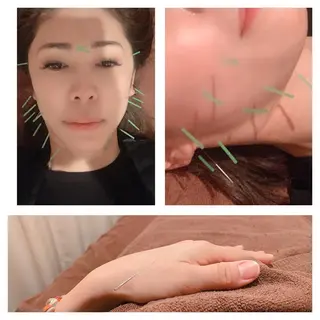 美容鍼灸イロドリ  のエステ・リラクイメージ