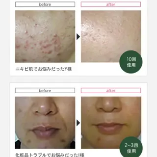 LEA MUSASHIKOSUGI所属・美肌育成サロン LEA武蔵小杉のエステ・リラクイメージ