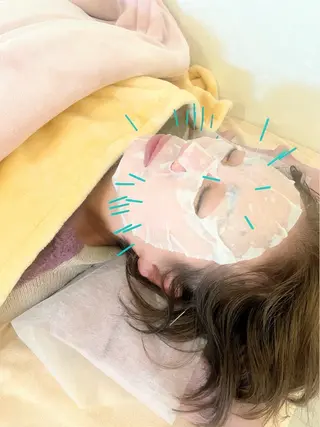 【妊活・美容鍼専門】Aran鍼灸院所属・【美容鍼・不妊専門】 Aran鍼灸院のエステ・リラクイメージ