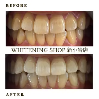 メンズ ホワイトニング ショップ新小岩店のその他イメージ