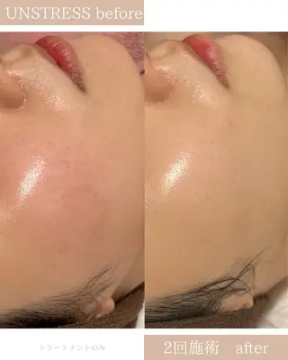 フェイシャルサロン シーラックス　河村のエステ・リラクイメージ