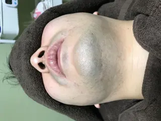 メンズ マンモス脱毛 札幌白石店のその他イメージ