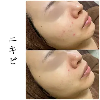 ハーブピーリング専門 BIOEL横浜のエステ・リラクイメージ