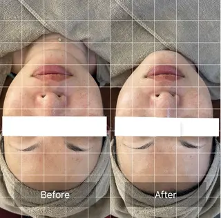 beauty salon y3所属・南野 琉夏のエステ・リラクイメージ