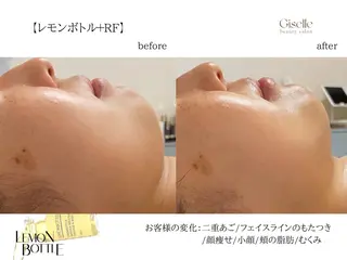 渡邉 由佳のエステ・リラクイメージ