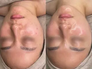 肌質改善・毛穴サロン Chéfiaのエステ・リラクイメージ